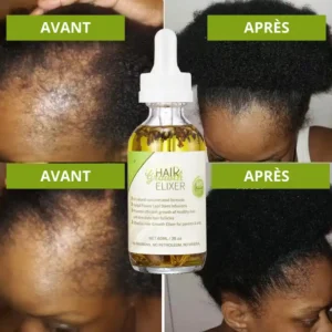 Sérum de Croissance cheveux – Image 4