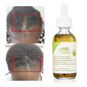 Sérum de Croissance cheveux – Image 2